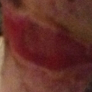 Helet sår på hesteben